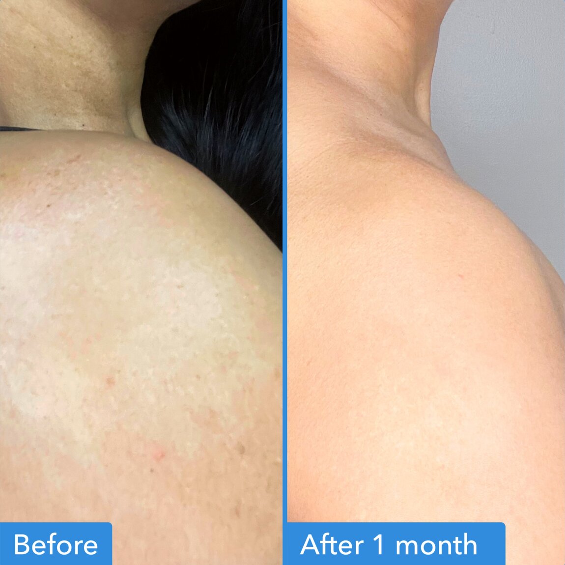 discoloration-correcting-body-treatment-q9 zb_p.jpg