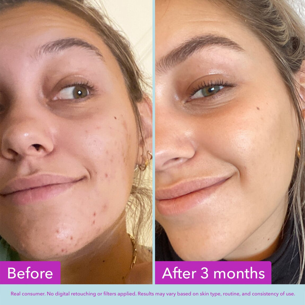 niacinamide-brightening-toner-a9 zb_p.jpg