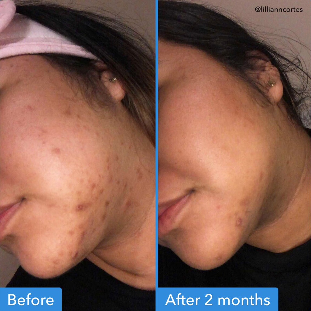 discoloration-correcting-serum-n8 zb_p.jpg