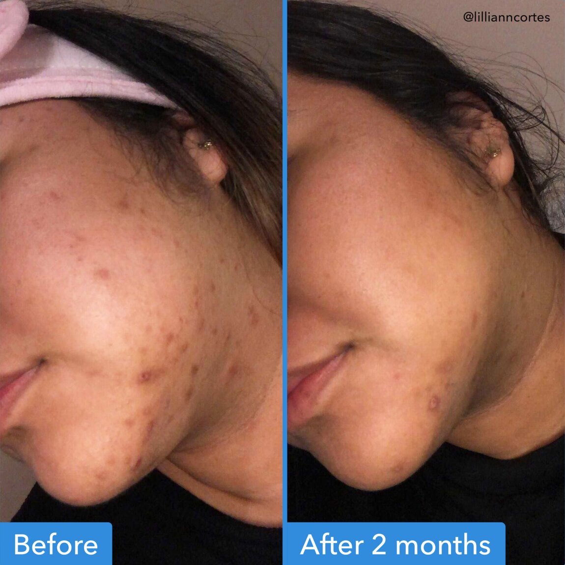 discoloration-correcting-serum-n8 zb_p.jpg